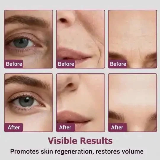 Calcium & Collagen Balm Stick | Remove Wrinkles, Smile Lines & Gives Hydration & Glow - Ummati_Essentials