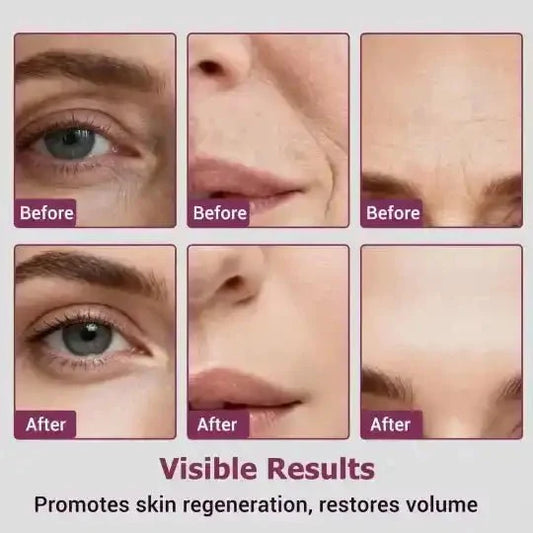 Calcium & Collagen Balm Stick | Remove Wrinkles, Smile Lines & Gives Hydration & Glow - Ummati_Essentials