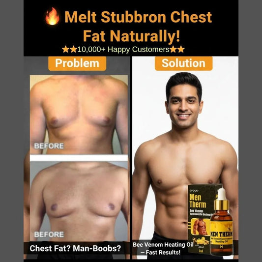 Chest Fat Bee Venom Gynecomastia Heating Oil - Ummati_Essentials