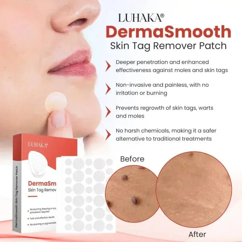 Derma Smooth Skin Tag Removal Patch - ✨ 100% Results - Ummati_Essentials