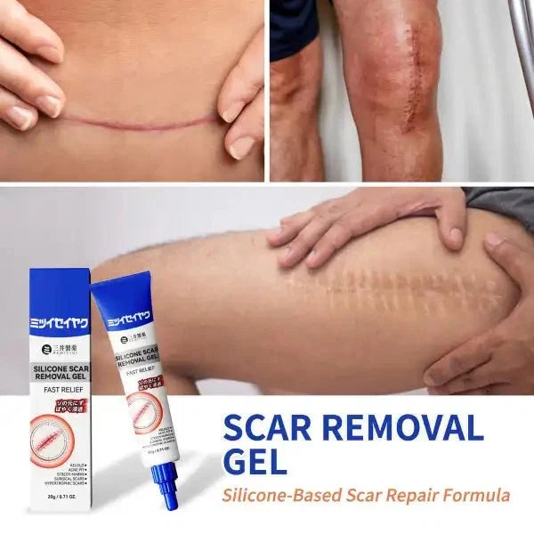 Silicone Scar Cream for Old and New Scars - Ummati_Essentials