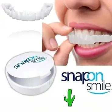 IMPORTED Snap-On Teeth Veneers - Ummati_Essentials