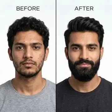 Dr. Alies Professional Beard Growth Oil – Natural 30ml - Ummati_Essentials