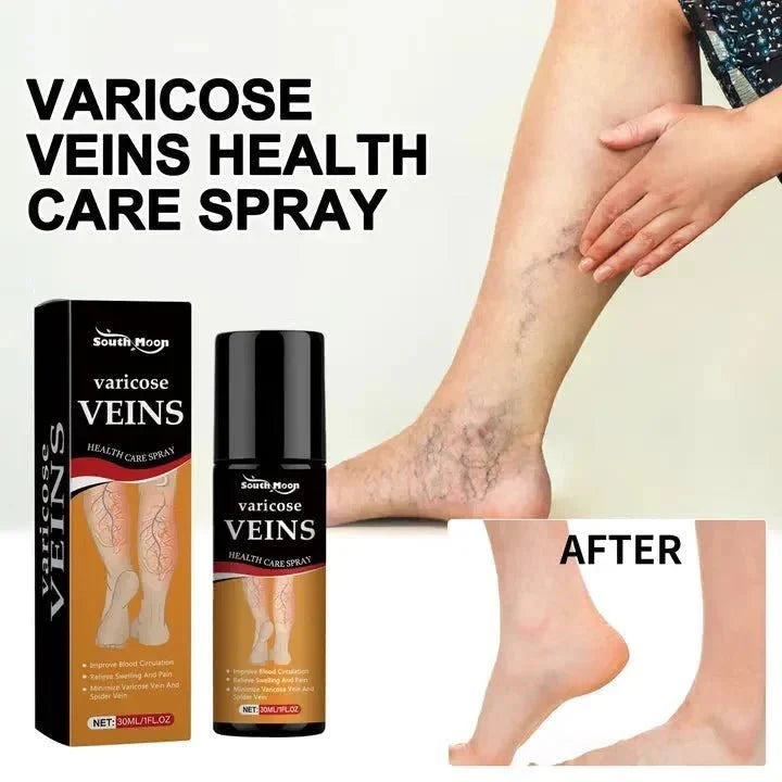 Varicose Vein Relief Spray - Ummati_Essentials