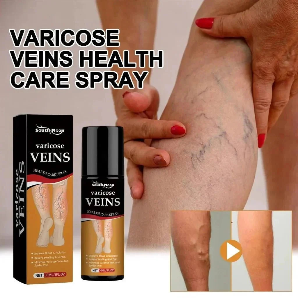 Varicose Vein Relief Spray - Ummati_Essentials